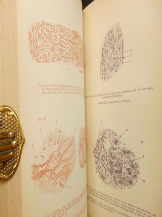 Diseases of the Heart and Thoracic Aorta